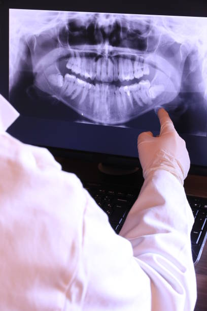 Best Emergency Treatment for Dental Infections or Abscesses in River Road, OR