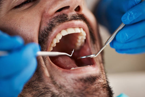 Best Emergency Dental Care for Broken or Chipped Teeth in River Road, OR